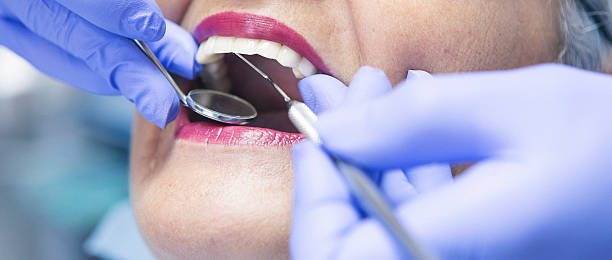 Best Knocked-Out Tooth Emergency  in Northwoods, MO